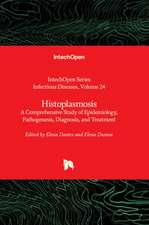 Histoplasmosis - A Comprehensive Study of Epidemiology, Pathogenesis, Diagnosis, and Treatment