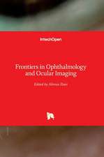 Frontiers in Ophthalmology and Ocular Imaging