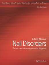 A Text Atlas of Nail Disorders: Techniques in Investigation and Diagnosis