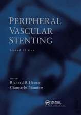 Peripheral Vascular Stenting, Second Edition