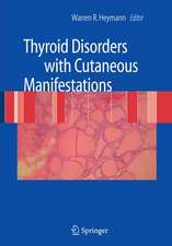 Thyroid Disorders with Cutaneous Manifestations