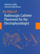 An Atlas of Radioscopic Catheter Placement for the Electrophysiologist