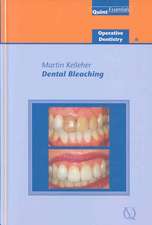 Dental Bleaching Operative Dentistry 6