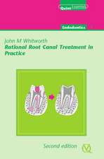 Rational Root Canal Treatment in Practice