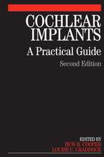 Cochlear Implants – A Practical Guide 2e