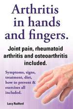 Arthritis in Hands and Arthritis in Fingers. Rheumatoid Arthritis and Osteoarthritis Included. Symptoms, Signs, Treatment, Diet, How to Prevent & Exer