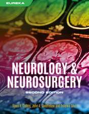 Eureka: Neurology and Neurosurgery, second edition