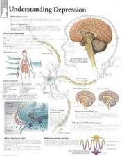 Understanding Depression Laminated Poster