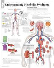 Metabolic Syndrome Chart: Laminated Wall Chart