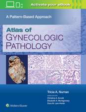 Atlas of Gynecologic Pathology