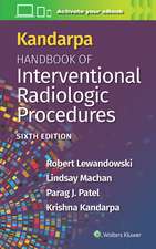 Kandarpa Handbook of Interventional Radiology Procedures