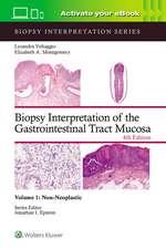 Biopsy Interpretation of the Gastrointestinal Tract Mucosa Volume 1: Non-Neoplastic: Print + eBook with Multimedia