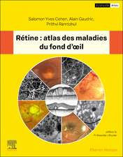 Rétine: atlas des maladies du fond d'oeil