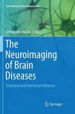 The Neuroimaging of Brain Diseases: Structural and Functional Advances