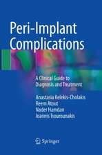 Peri-Implant Complications: A Clinical Guide to Diagnosis and Treatment