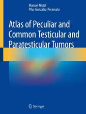 Atlas of Peculiar and Common Testicular and Paratesticular Tumors