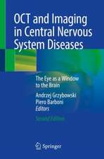 OCT and Imaging in Central Nervous System Diseases: The Eye as a Window to the Brain