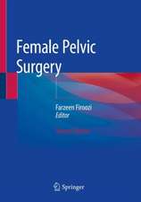 Female Pelvic Surgery