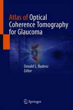 Atlas of Optical Coherence Tomography for Glaucoma