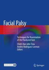 Facial Palsy: Techniques for Reanimation of the Paralyzed Face