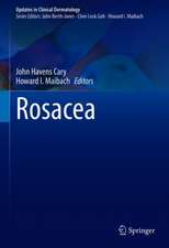 Rosacea