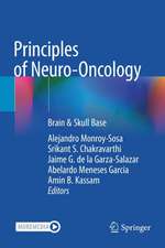 Principles of Neuro-Oncology: Brain & Skull Base