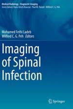 Imaging of Spinal Infection