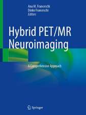 Hybrid PET/MR Neuroimaging: A Comprehensive Approach