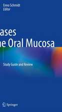 Diseases of the Oral Mucosa