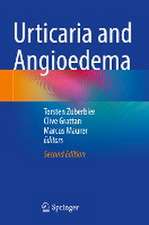 Urticaria and Angioedema