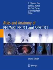 Atlas and Anatomy of PET/MRI, PET/CT and SPECT/CT