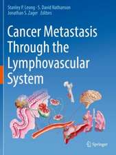 Cancer Metastasis Through the Lymphovascular System