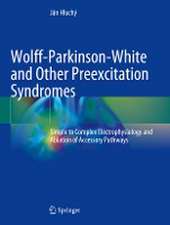 Wolff-Parkinson-White and Other Preexcitation Syndromes: Simple to Complex Electrophysiology and Ablation of Accessory Pathways