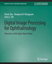 Digital Image Processing for Ophthalmology: Detection of the Optic Nerve Head