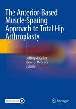 The Anterior-Based Muscle-Sparing Approach to Total Hip Arthroplasty