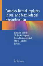 Complex Dental Implants in Oral and Maxillofacial Reconstruction