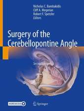 Surgery of the Cerebellopontine Angle