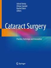 Cataract Surgery