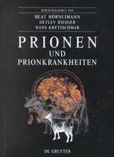 Prionen und Prionkrankheiten