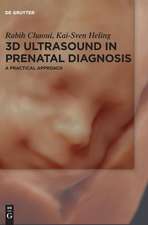 3D Ultrasound in Prenatal Diagnosis