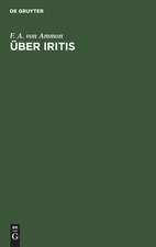 Über Iritis: 6 Bücher