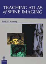 Teaching Atlas of Spine Imaging