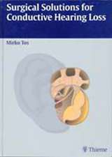 Surgical Solutions for Conductive Hearing Loss: Man Middle Ear Surgery, Volume 4