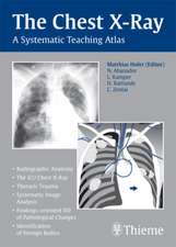 The Chest X–Ray – A Systematic Teaching Atlas