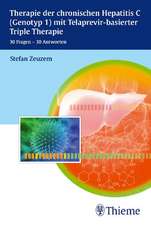 Therapie der chronischen Hepatitis C mit Telaprevir-basierter Triple Therapie