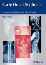 Early Onset Scoliosis – A Comprehensive Guide from the Oxford Meetings