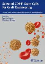 32 Cases on Stem Cell Transplantation