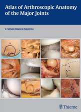 Atlas of Arthroscopic Anatomy of the Major Joints