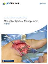 Manual of Fracture Management – Hand