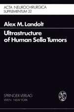 Ultrastructure of Human Sella Tumors: Correlations of Clinical Findings and Morphology